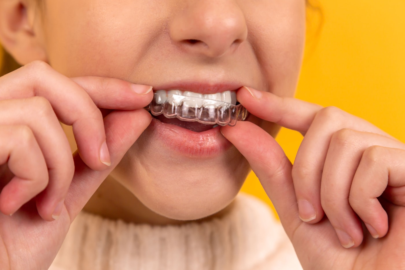 Patient placing a clear aligner tray