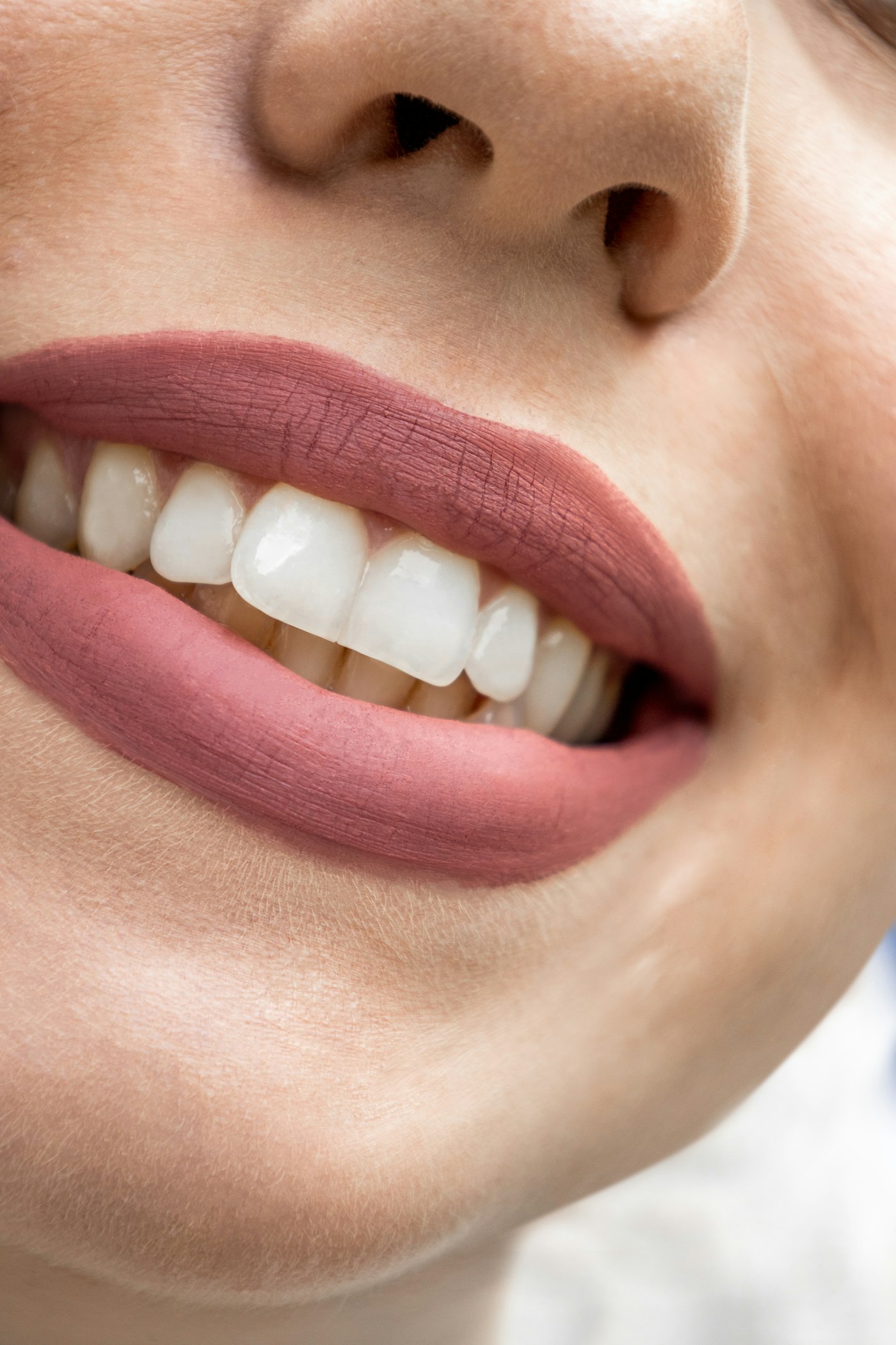 Teeth Polishing