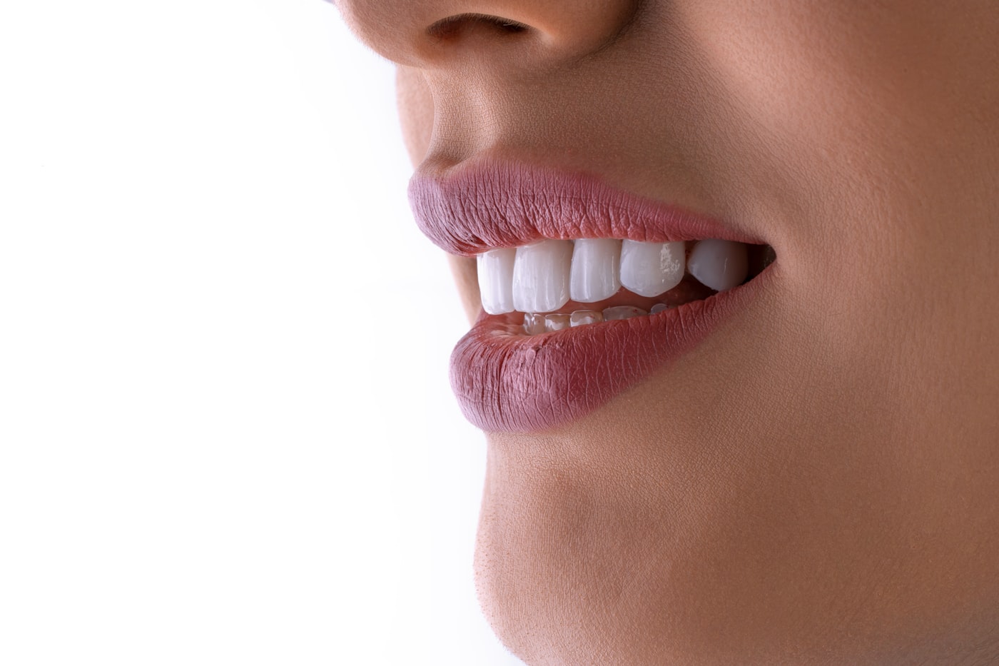Smile Designing
